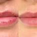 Permanent Lip Color Healing Process